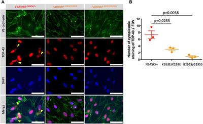 Establishment of a novel amyotrophic lateral sclerosis patient (TARDBPN345K/+)-derived brain microvascular endothelial cell model reveals defective Wnt/β-catenin signaling: investigating diffusion barrier dysfunction and immune cell interaction
